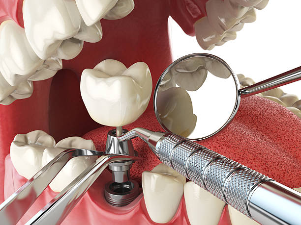 Best Orthodontic Emergency Dentist in New Haven, MO